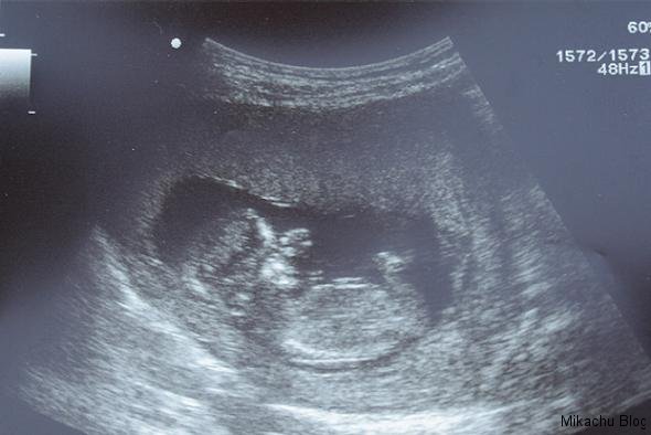 1stscan.jpg