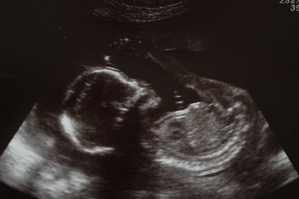 2ndscan